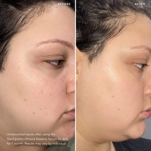 GenOptics Ultraura Essence is SK II's best-selling brightening serum to visibly reduce dullness and target sun spots slide2